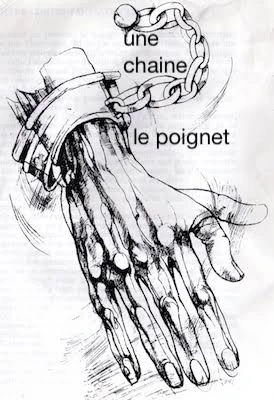Gravure d'une main d'homme écorchée, les tendons à nu, le poignet cerclé d'un bracelet de fer relié à une chaîne. Deux annotations manuscrites : « une chaine » et « le poignet ».
